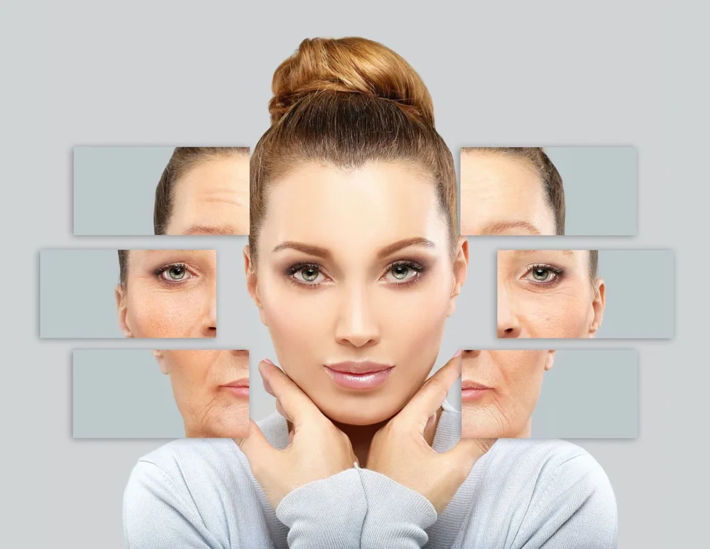 Portfolio 43 Neurotoxin Injections in San Ramon, CA | Solei Clinic