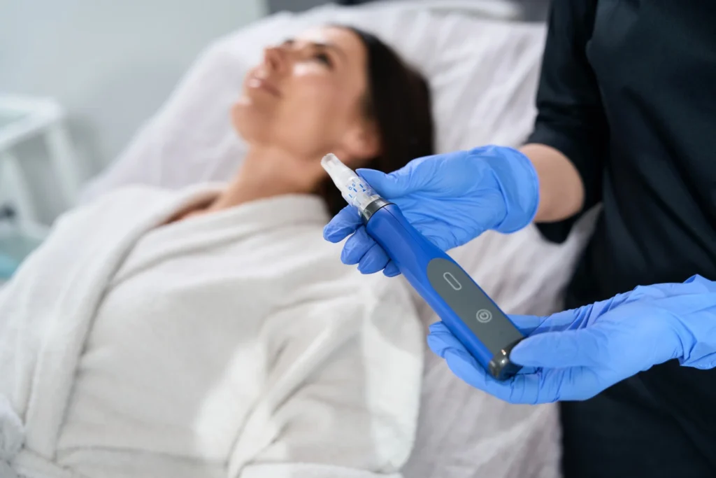 Portfolio 1 Microneedling Treatment in San Ramon, CA | Solei Clinic