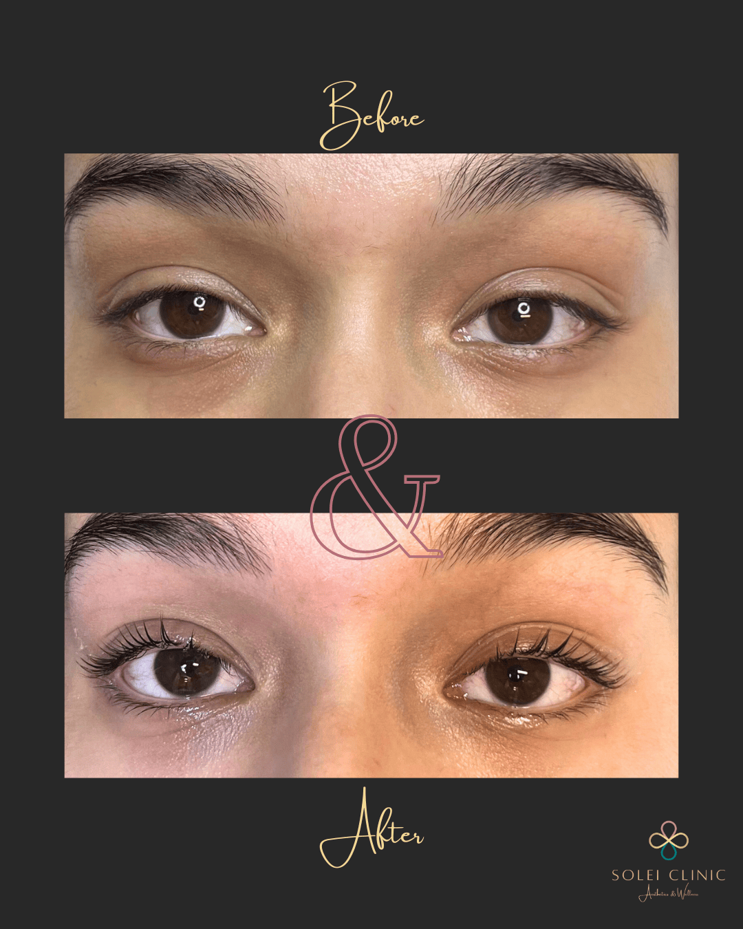 Lash Lift