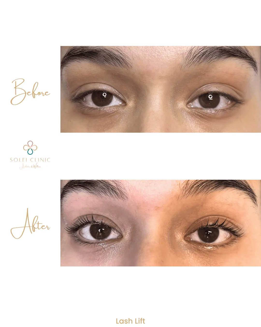 Lash Lift