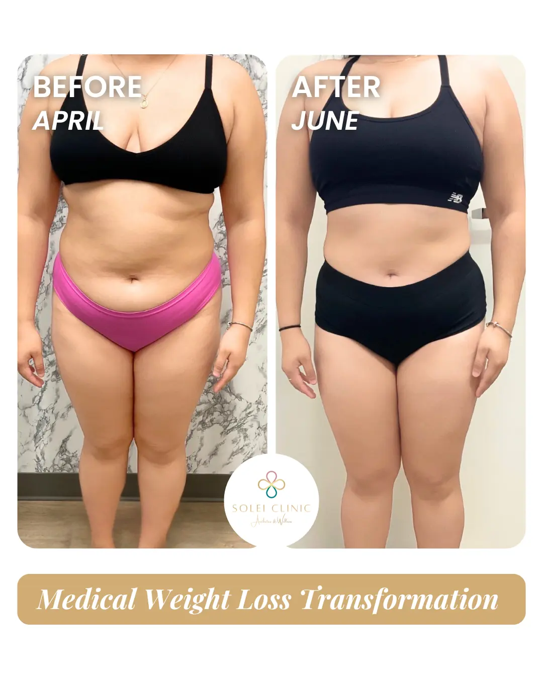 Weight Loss 1