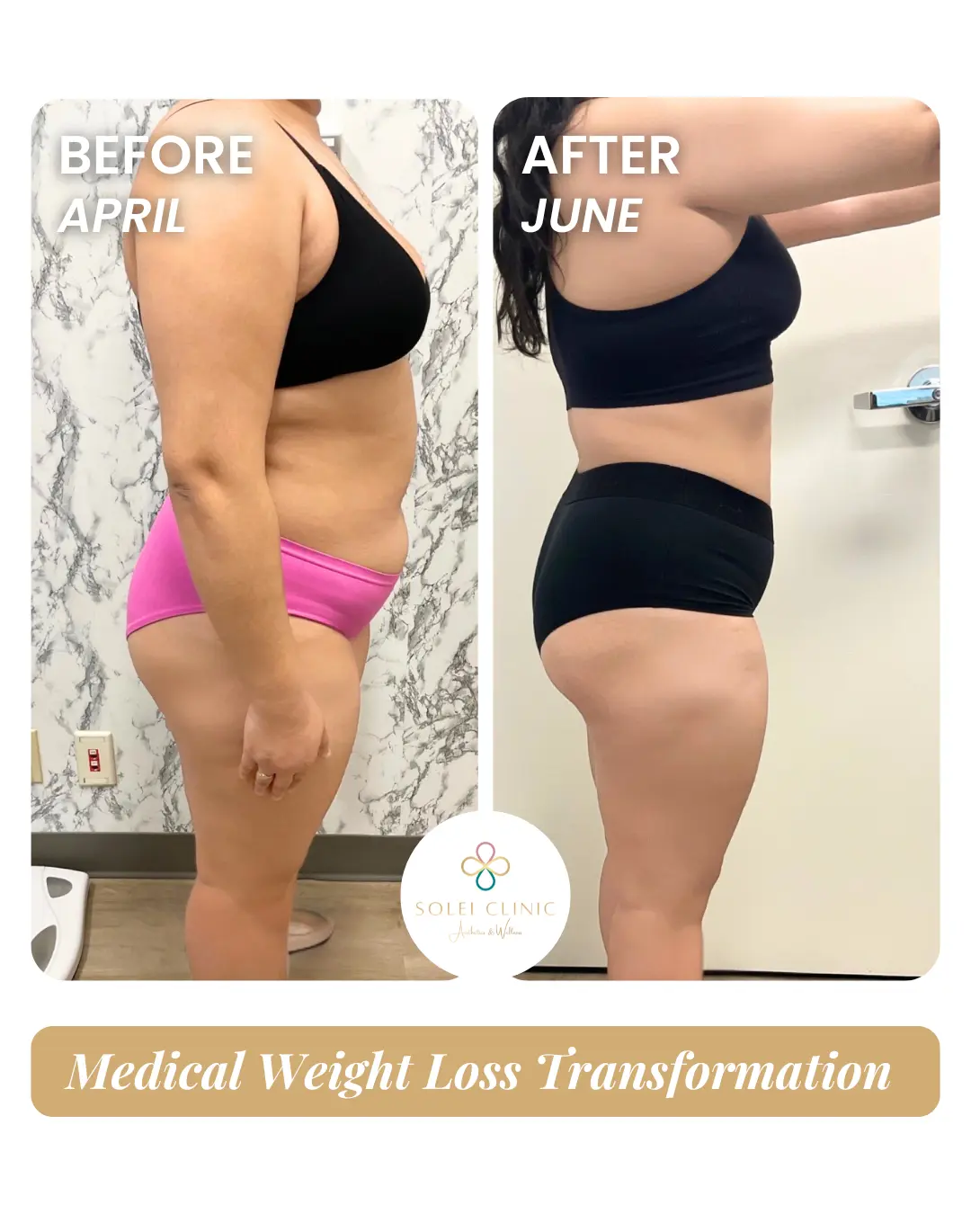 Weight Loss 2