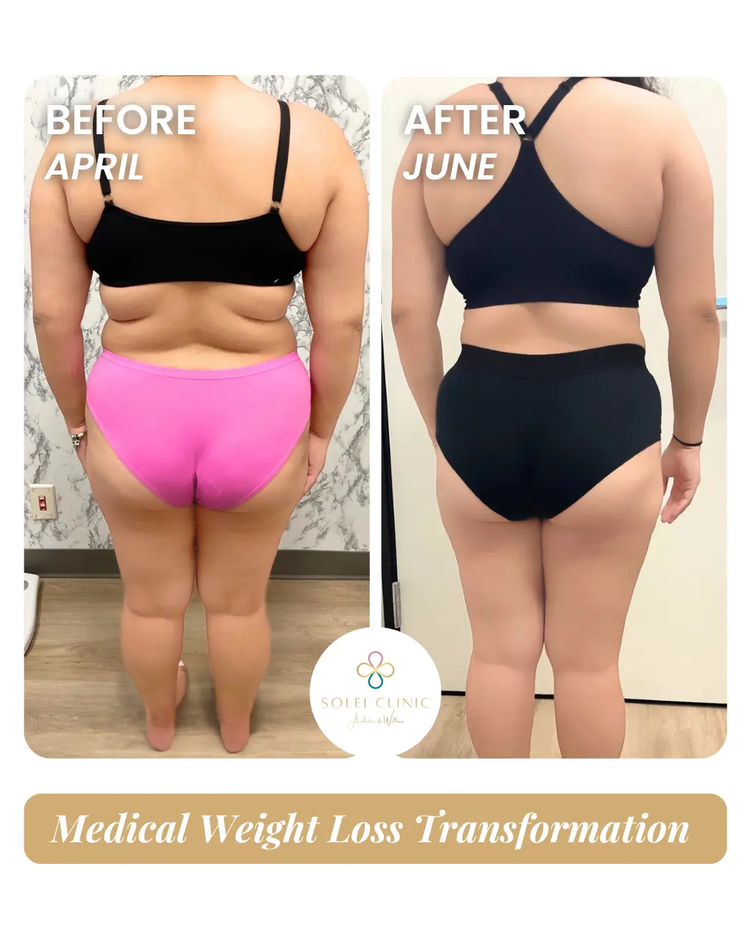 Weight Loss 3
