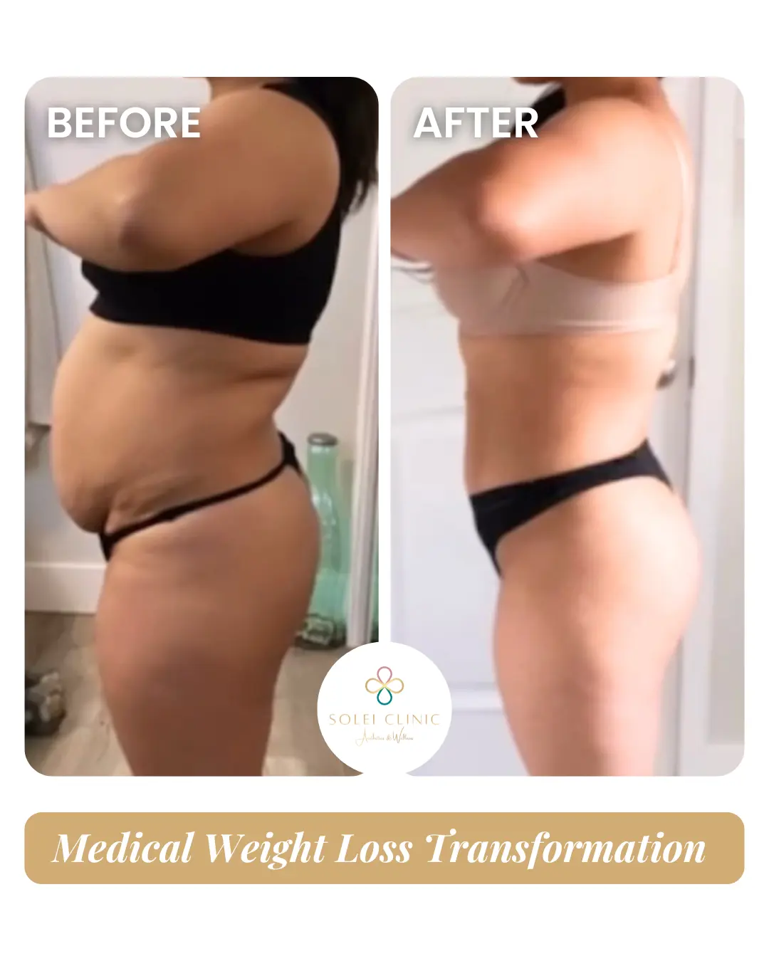 Weight Loss 4