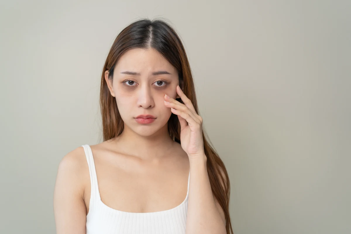 Dark Circles Treatment
